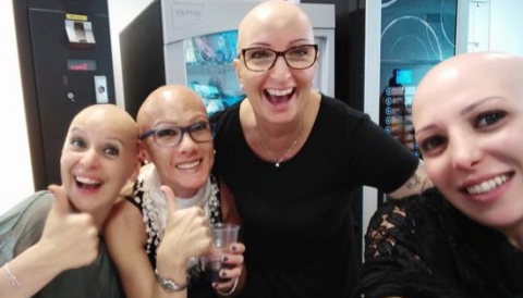 Quando si diventa calvi all'improvviso: «E' l'alopecia areata, male non riconosciuto»